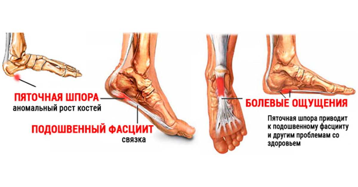 ÐÑÑÐºÐ° ÑÐ¿Ð¾ÑÐ°