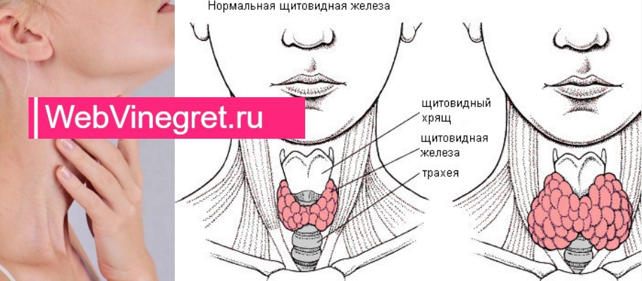 Расположение щитовидки на горле фото