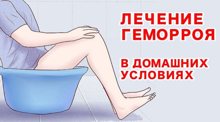 Как вылечить геморрой народными средствами.