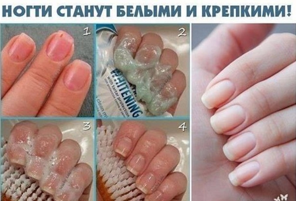Чтобы ногти всегда выглядели ухоженными и были белыми, длинными и крепкими советую этот рецепт!