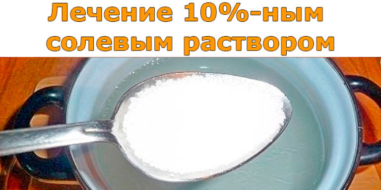 Лечение 10%-ным солевым раствором