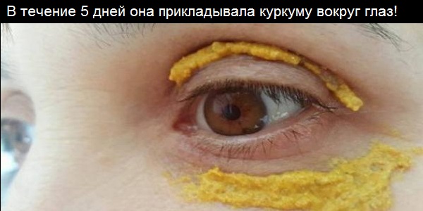 В течение 5 дней она прикладывала куркуму вокруг глаз! И вот что случилось!