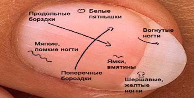 ЧТО ГОВОРЯТ НОГТИ О НАШЕМ ЗДОРОВЬЕ