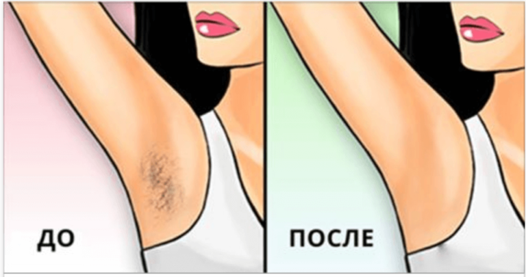 3 отличных способа не брить подмышки, но сделать их гладкими как фарфор