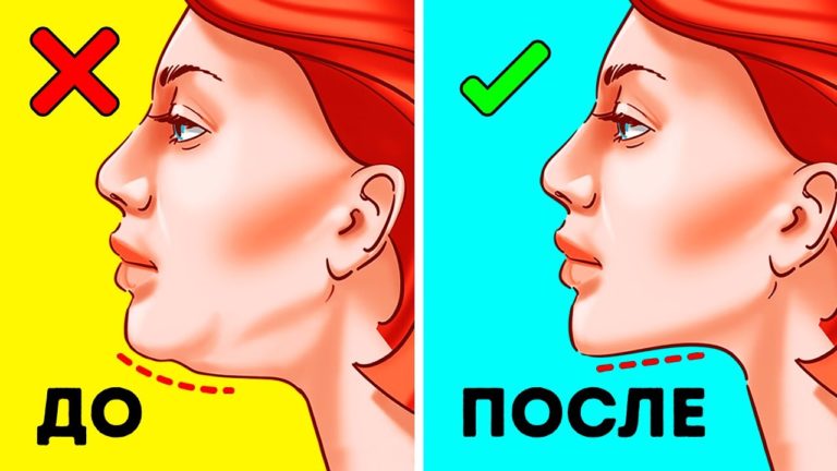 Вот как быстро избавиться от двойного подбородка