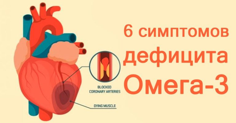 Эти 6 признаков дефицита Омега-3 стоит знать всем, особенно женщинам!