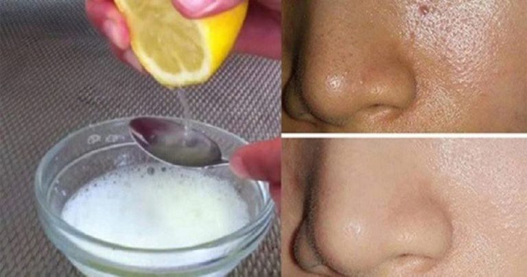 Как сузить поры кожи в домашних условиях