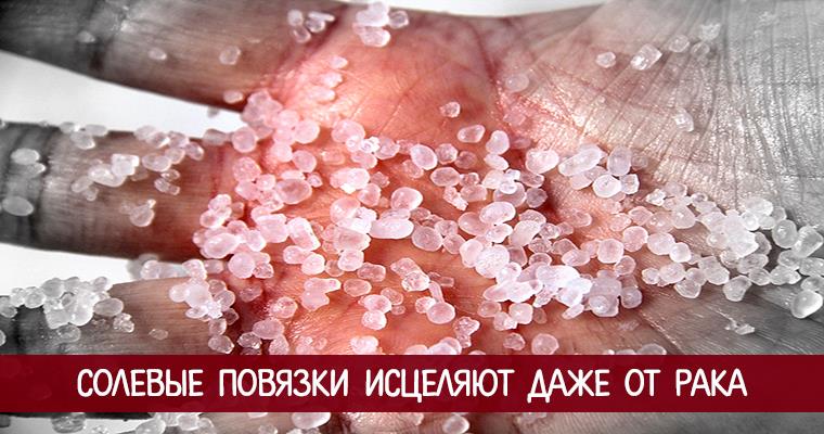Невероятно! Обычные солевые повязки исцеляют даже от рака