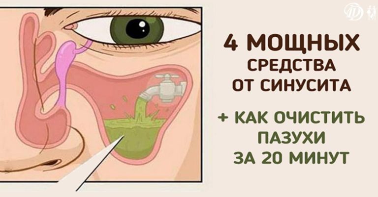 Если вас замучил насморк, попробуйте эти 4 мощных средства!
