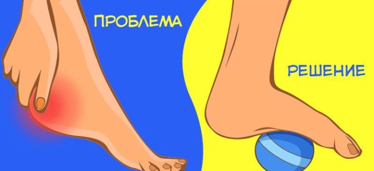 Простые упражнения, которые помогут вам избавиться от болей в области тазобедренного сустава, колена или стопы