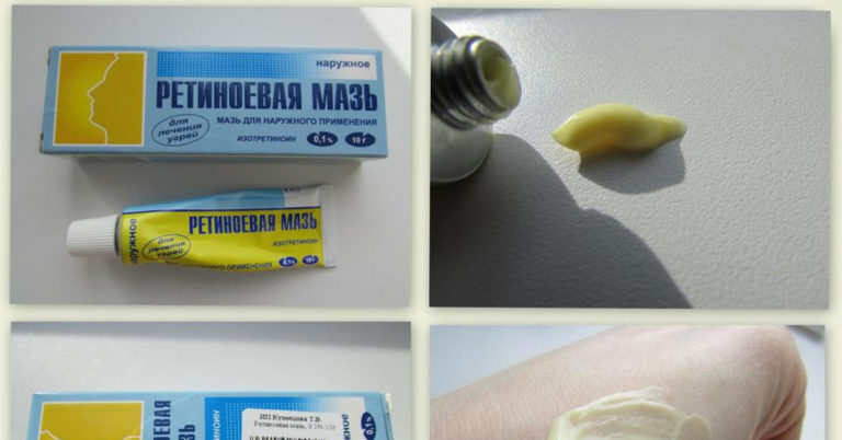 Копеечные средства для красоты из аптеки. Обычная косметика в долю не падает