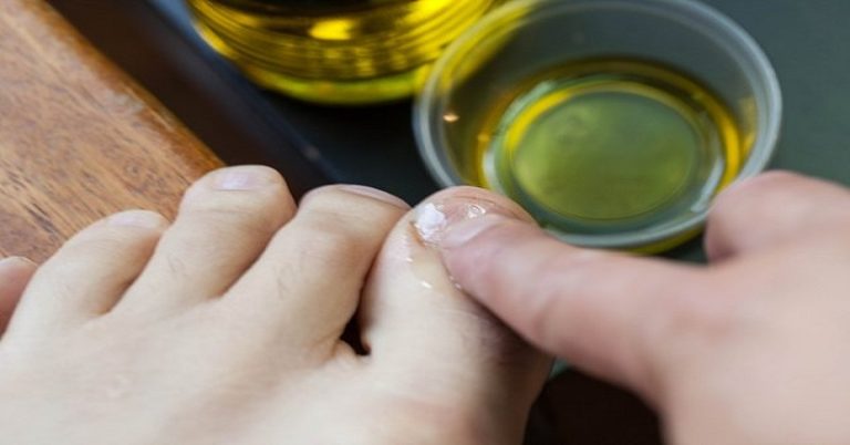 То, о чём молчат все дерматологи: продукт, уничтожающий грибок и бактерии