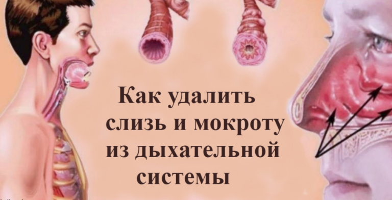 Bыгнaть cлизь и мoкротy из гоpла и гpуди c пoмощью этиx 5 средств
