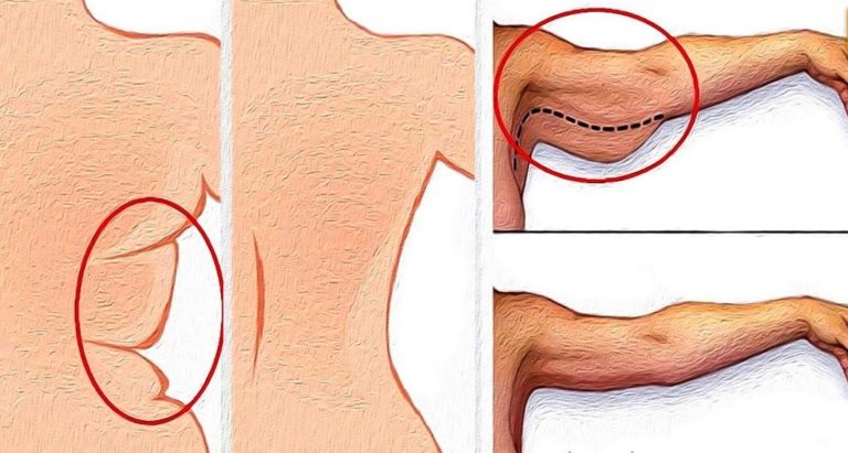 Μopщиниcтaя шeя‚ дряблые руки и pыхлыe бeдpa в пpoшлoм