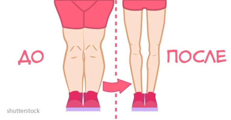 10 упражнений для стройных ног и подтянутых ягодиц