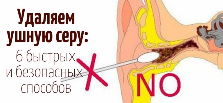 Как правильно чистить уши в домашних условиях