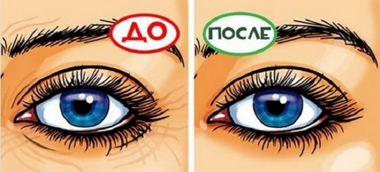 5 домашних масок для кожи вокруг глаз, которые разгладят морщинки и предотвратят гусиные лапки