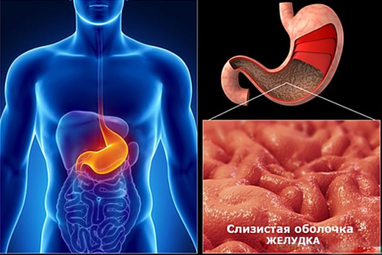 Целебные средства от гастрита
