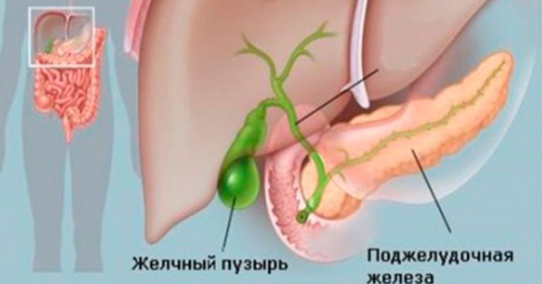 Легкое очищение желчного пузыря