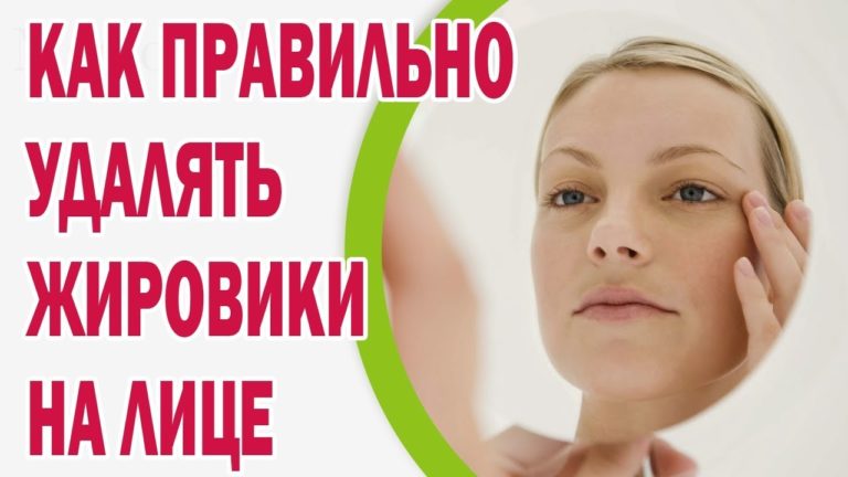 На лице жировики: лучшие методы избавления в самые короткие сроки