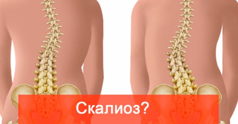 Проблемы с позвоночником. Какие причины