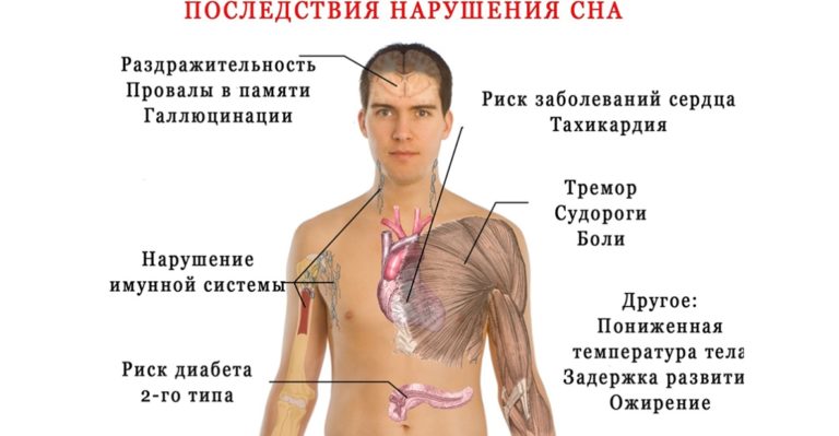 Вы Знаете Насколько Опасна Бессонница. 8 Последствий Нарушения Сна