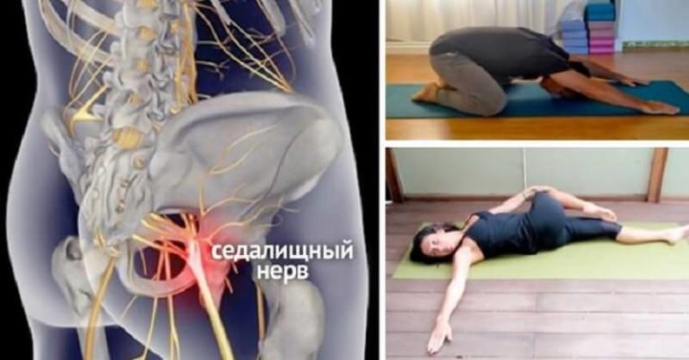 Попробуй 8 простых упражнений, с которыми навсегда забудешь о болях в спине