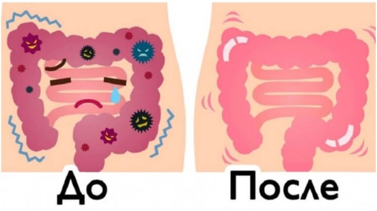 1 стакан воды+3 ингридиента — так я очистила толстую кишку от всех токсичных отходов