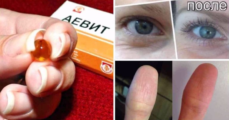 Лекарство «Аевит» творит чудеса. Действенное средство за копейки…