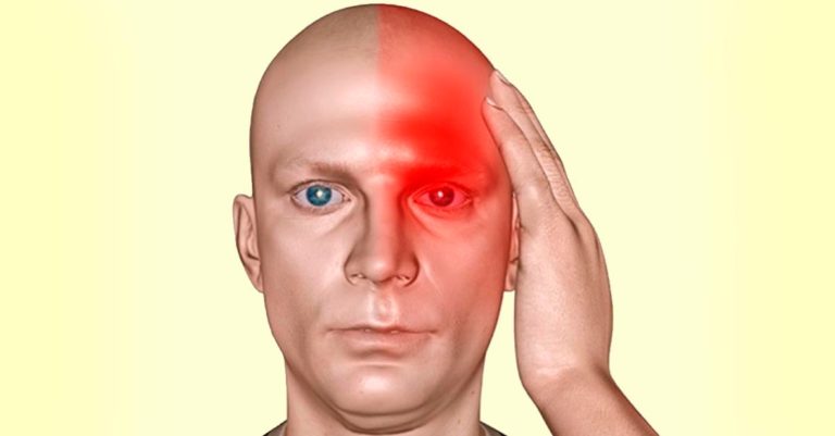 Тихий инсульт: предупреждающие симптомы. Факторы риска
