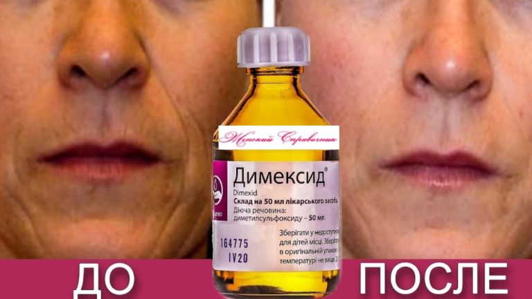 Омолаживаем кожу с помощью димексида