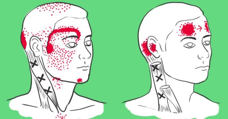 Нехватка этих продуктов вызывает головную боль. Жаль, что не знала об этом раньше