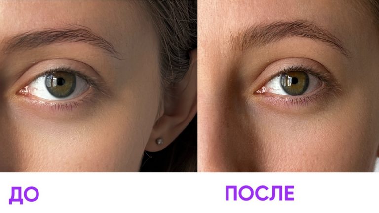Смотри, как отрастить шикарные ресницы и брови в домашних условиях
