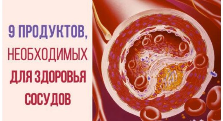 9 продуктов, которые естественным способом очищают артерии