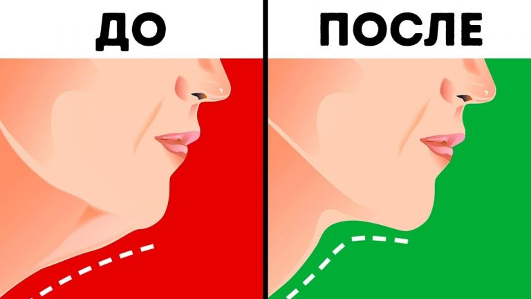 Эликсир для упругой шеи и подбородка. Как ухаживать за шеей и подбородком, что бы они были упругими