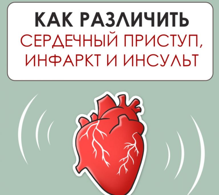 Как различить сердечный приступ, инфаркт и инсульт