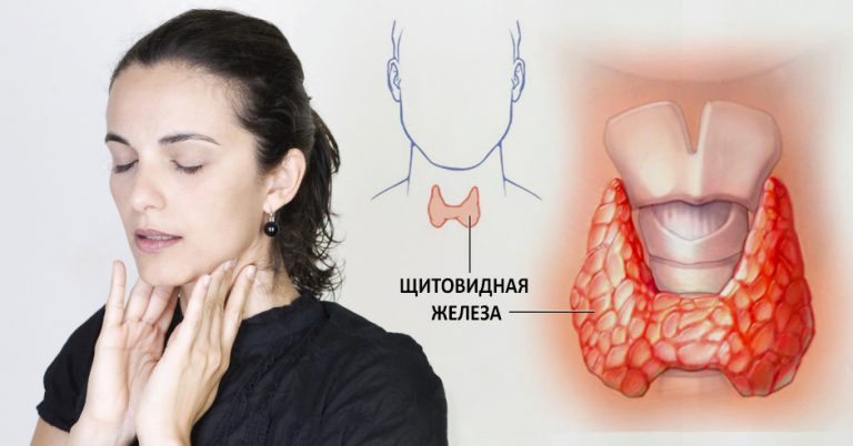 Как вылечить щитовидную железу с помощью всего двух ингредиентов