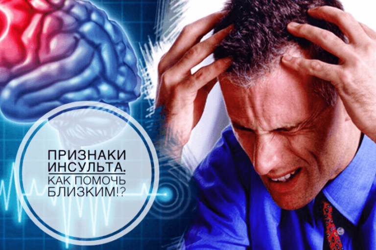 Вот 4 признака, что у человека сегодня может случиться инсульт