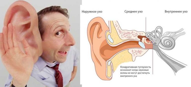 7 рецептов, как вернуть потерянный слух. Лечится даже старческая тугоухость и сильное ухудшение слуха