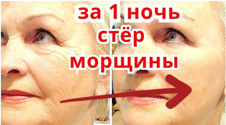 Избавляемся от морщин за ночь