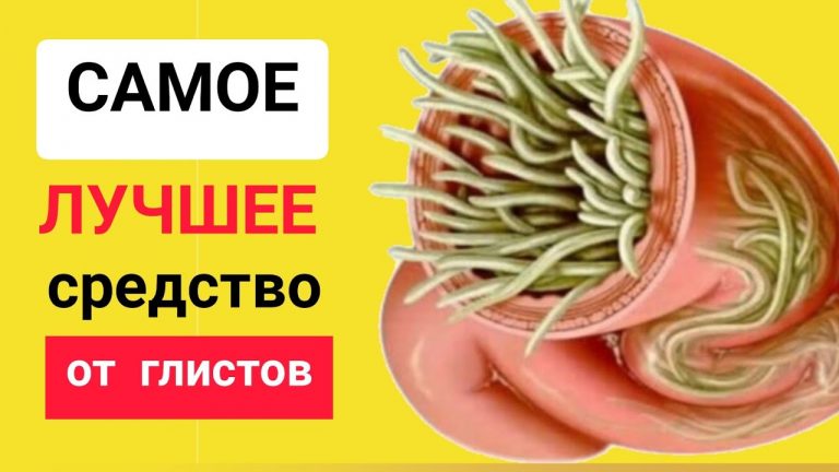Как эффективно избавиться от глистов: никакие таблетки не сравнятся с этим средством