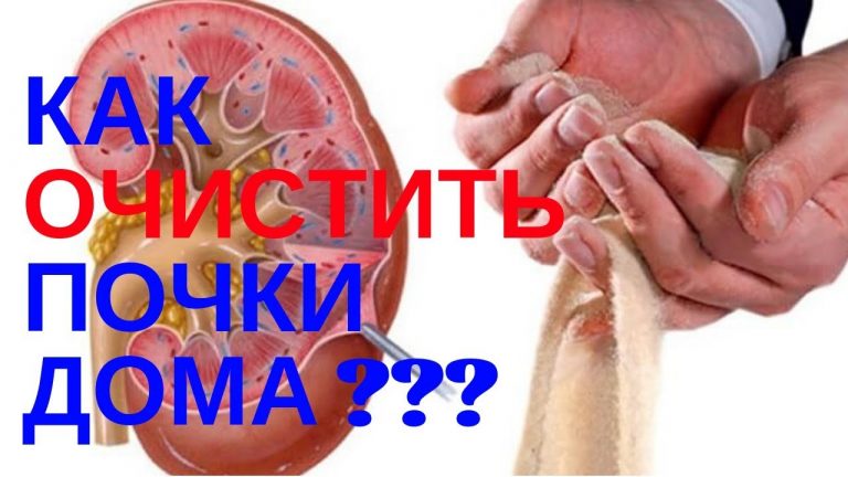 Как вывести песок из почек