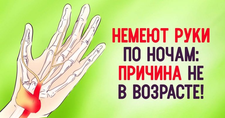 Немеют руки по ночам: причина — не в возрасте
