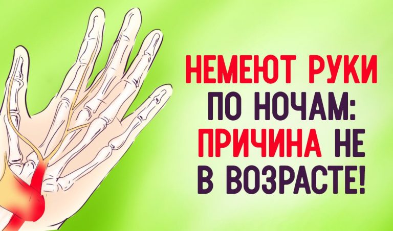 Почему немеют руки: 7 причин, заставляющих задуматься о здоровье
