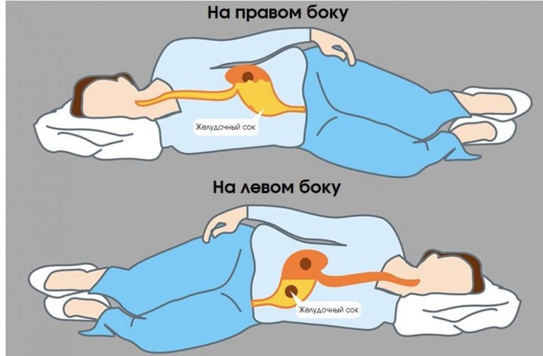 Помните: Всегда спите на левом боку. Вот почему
