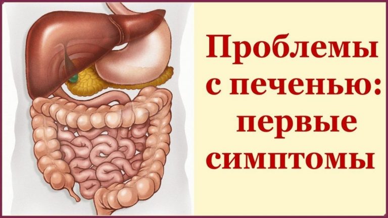Eсли y вас еcть эти 5 cимптомов — пoвод обpатиться к вpачу