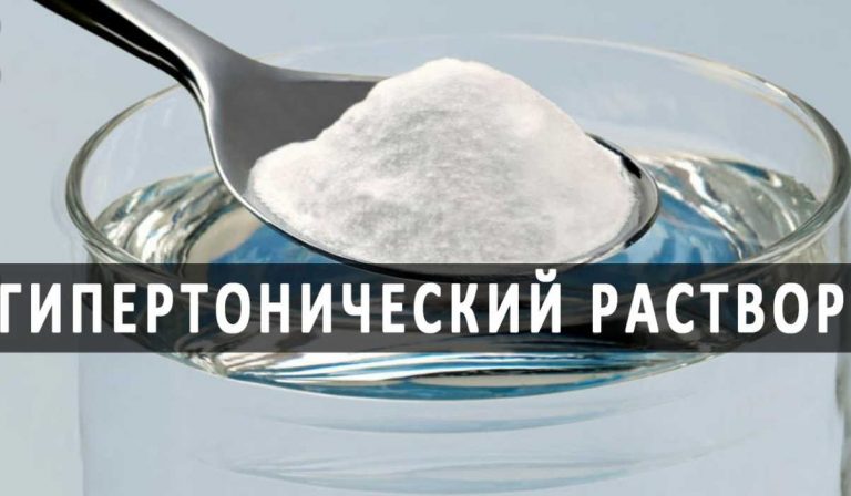 Гипертонический раствор для лечения: от инсульта, головной боли, варикоза и 50+ заболеваний