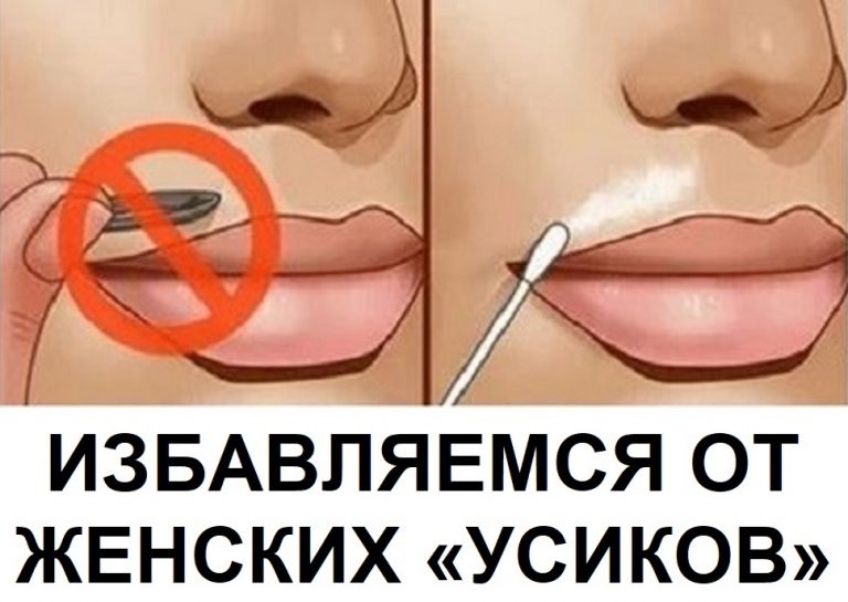 Как легко навсегда избавиться от женских «усиков»