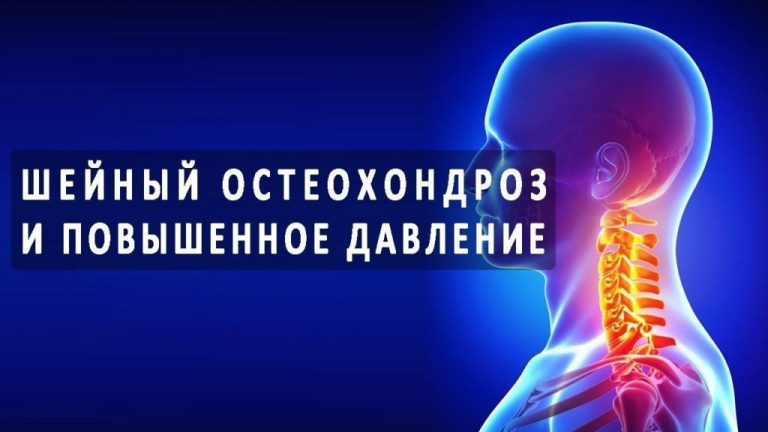 Неразлучная парочка. Шейный остеохондроз и высокое давление
