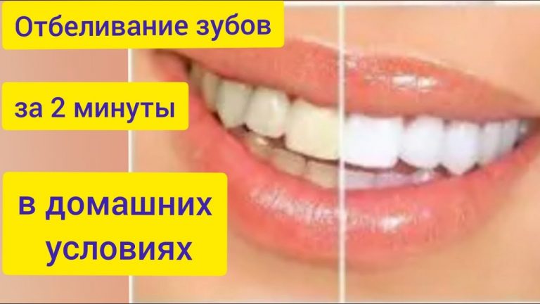 Отбеливание желтых зубов менее чем за 2 минуты